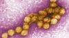 Aufnahme des West-Nil-Virus im Elektronenmikroskop. Das Virus ist nun auch bei einem Falken nachgewiesen worden.