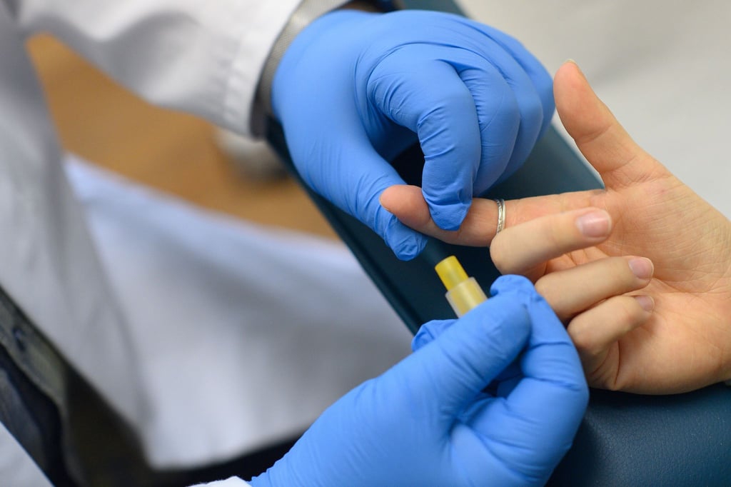 Für einen HIV-Test wird Blut entnommen. (Archivbild)