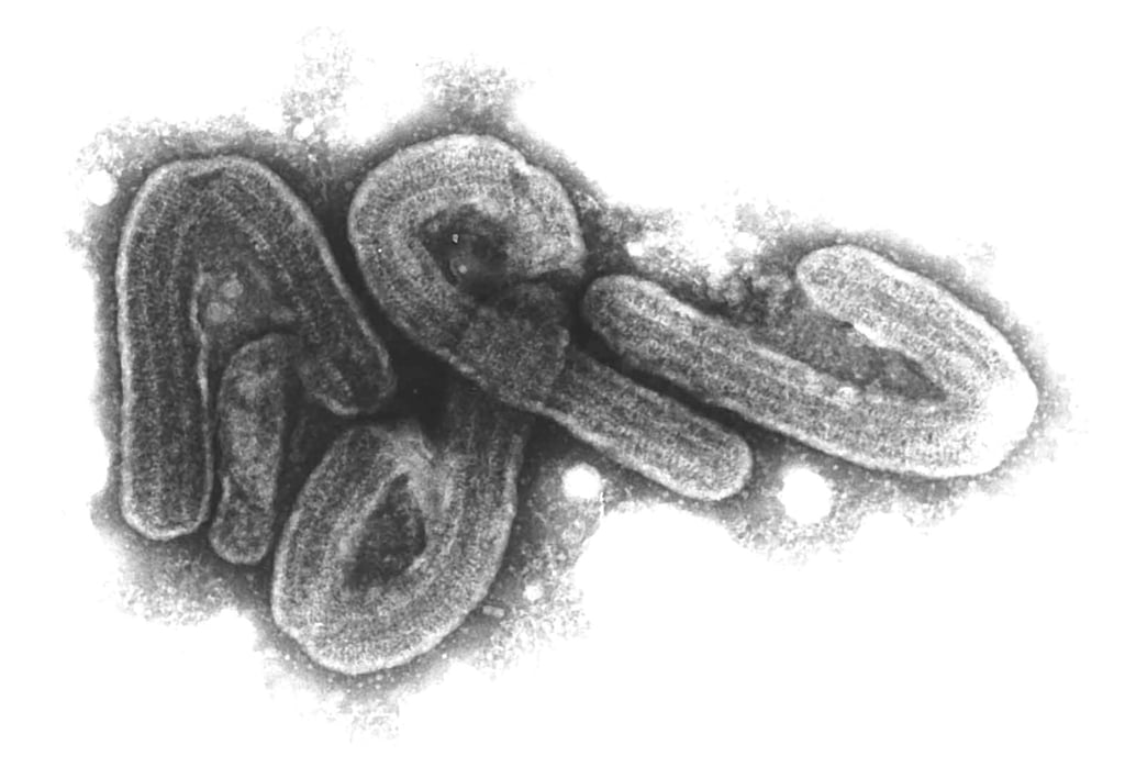 Eine elektronenmikroskopische Aufnahme des Marburg-Virus. (Archivbild)