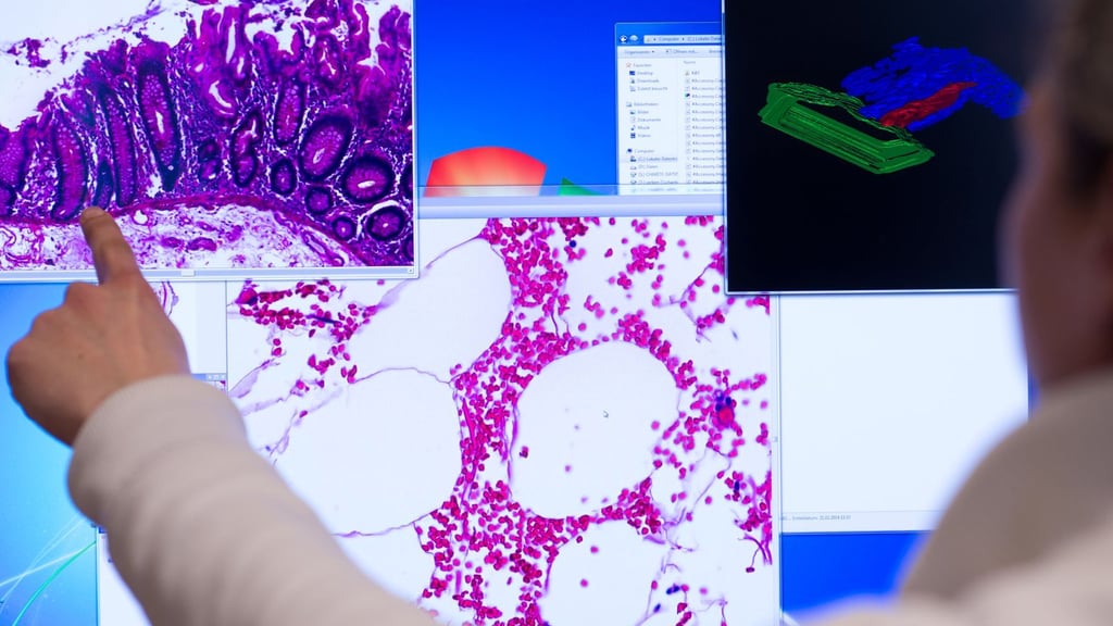 Unglaublich Trauriger Spitzenreiter Rekord Raser Mit 321 Kmh Erwischt Die Bilder - qxvf3bb