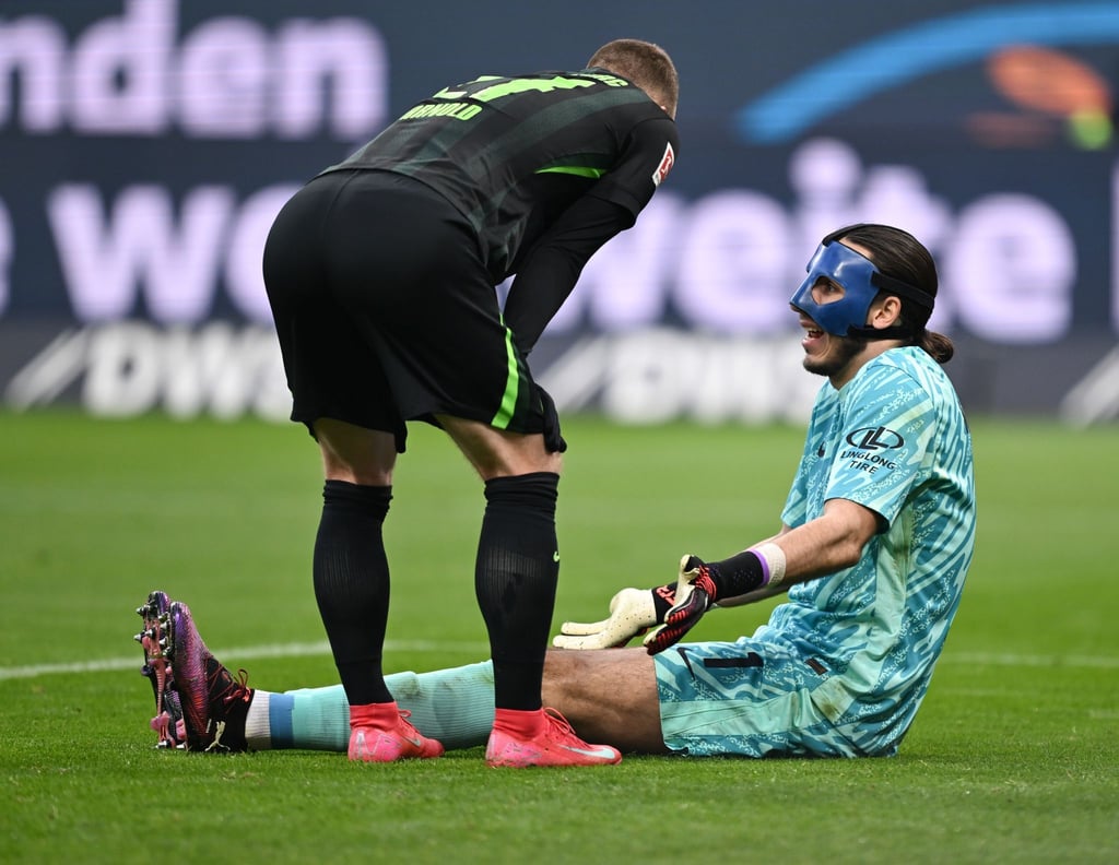 Wolfsburgs Stammkeeper Kamil Grabara musste in Frankfurt wegen einer Muskelverletzung ausgewechselt werden.