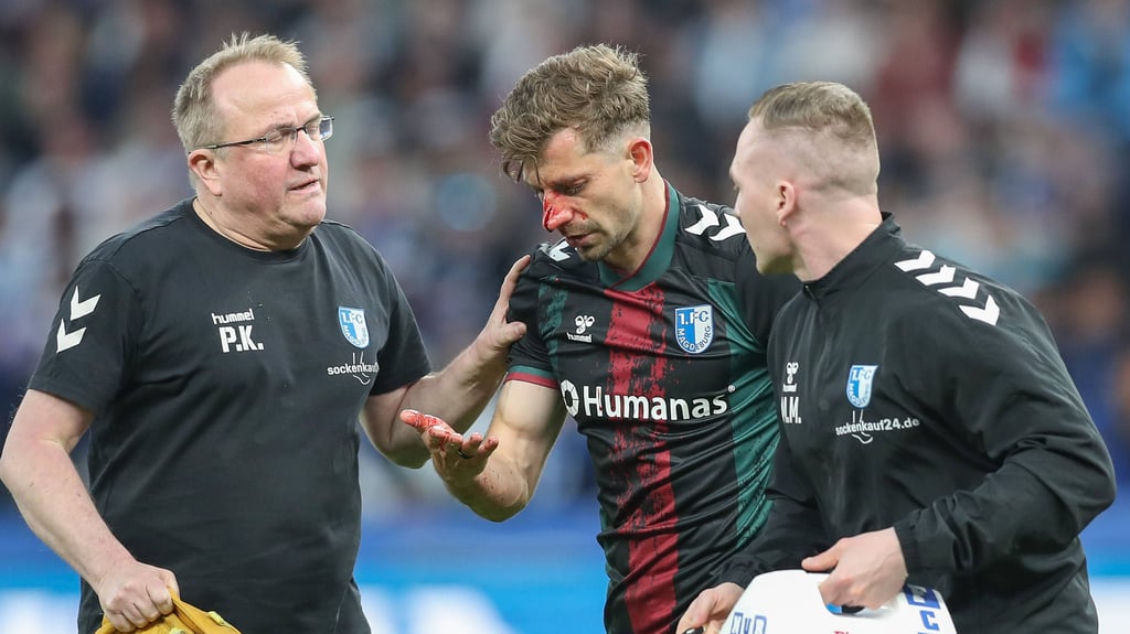 Alexander Nollenberger vom 1. FC Magdeburg zog sich gegen Hertha BSC Berlin eine blutende Nase zu.