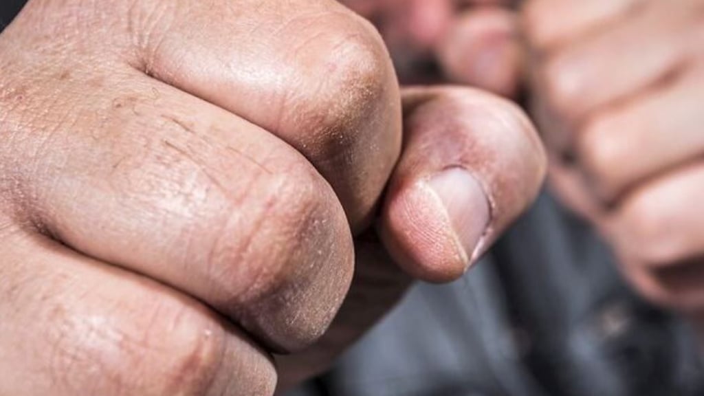 Eine Gruppe vermummter Männer hat einen 47-Jährigen an der Straßenbahnhaltestelle Steintor/Magdeburger Straße angegriffen.