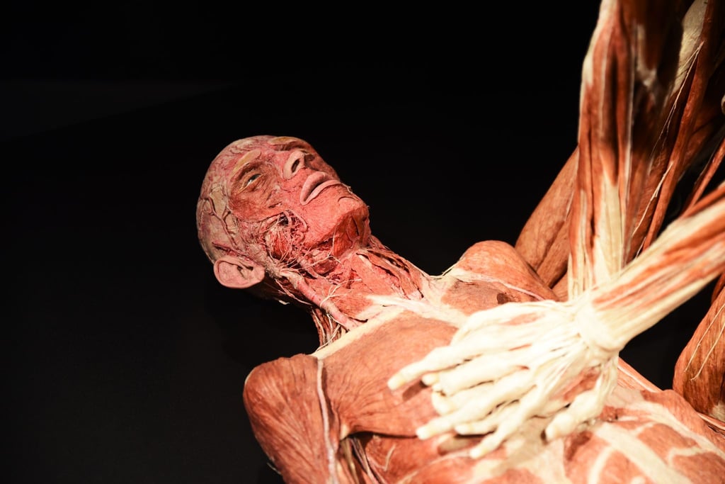 Das Plastinat „Der Lebensretter“ zeigt in der "Körperwelten"-Schau in Magdeburg eine Wiederbelebung.