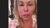 Brandi Glanville leidet unter einer mysteriösen Erkrankung, die ihr Gesicht massiv verändert hat.