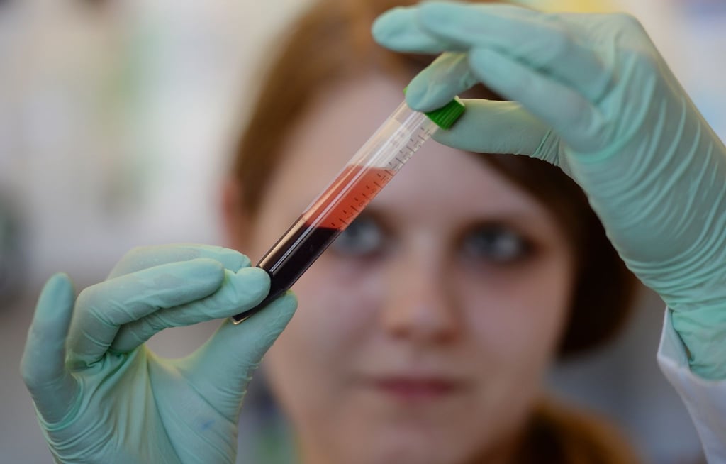 Der Anteil der schwangeren Frauen, die einen vorgeburtlichen Bluttest auf Trisomien vornehmen lassen, steigt nach Daten der Krankenkasse Barmer in Niedersachsen. (Symbolbild)