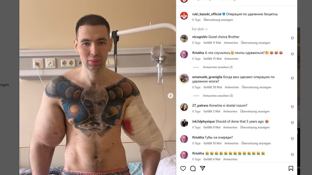 Der Russe Kirill Tereshin war mit seinem übergroßen Bizeps im Krankenhaus gelandet.