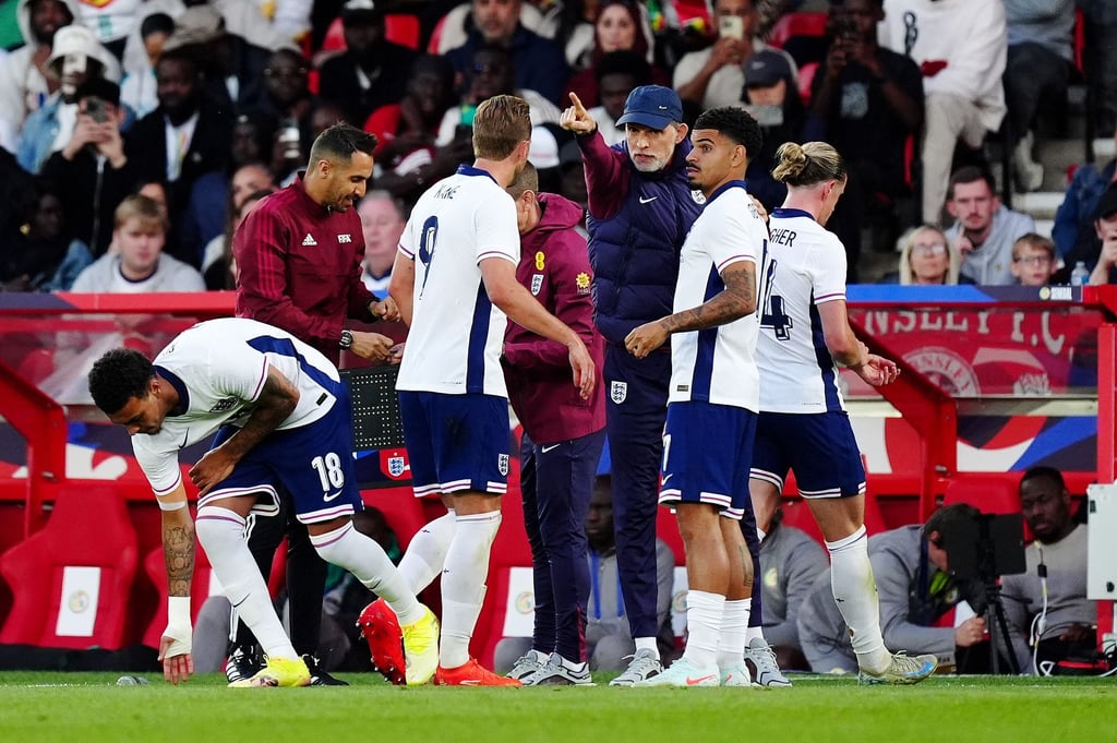 Englands Trainer Thomas Tuchel (M) konnte mit der Leistung seiner Spieler gegen das Team aus Senegal nicht zufrieden sein.