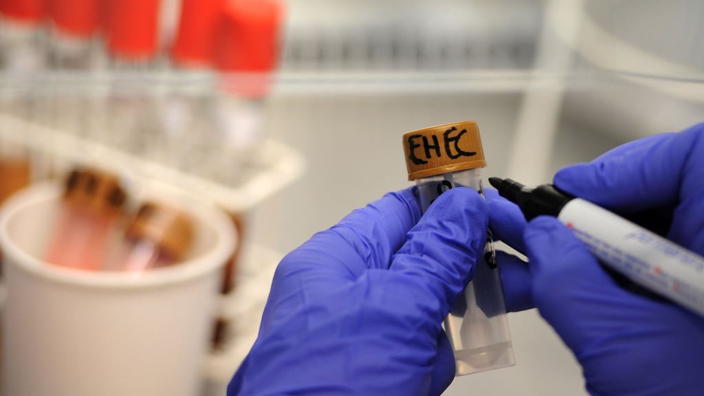 Rinder-Salami wird wegen einer möglichen bakteriellen Belastung zurückgerufen. (Symbolbild)