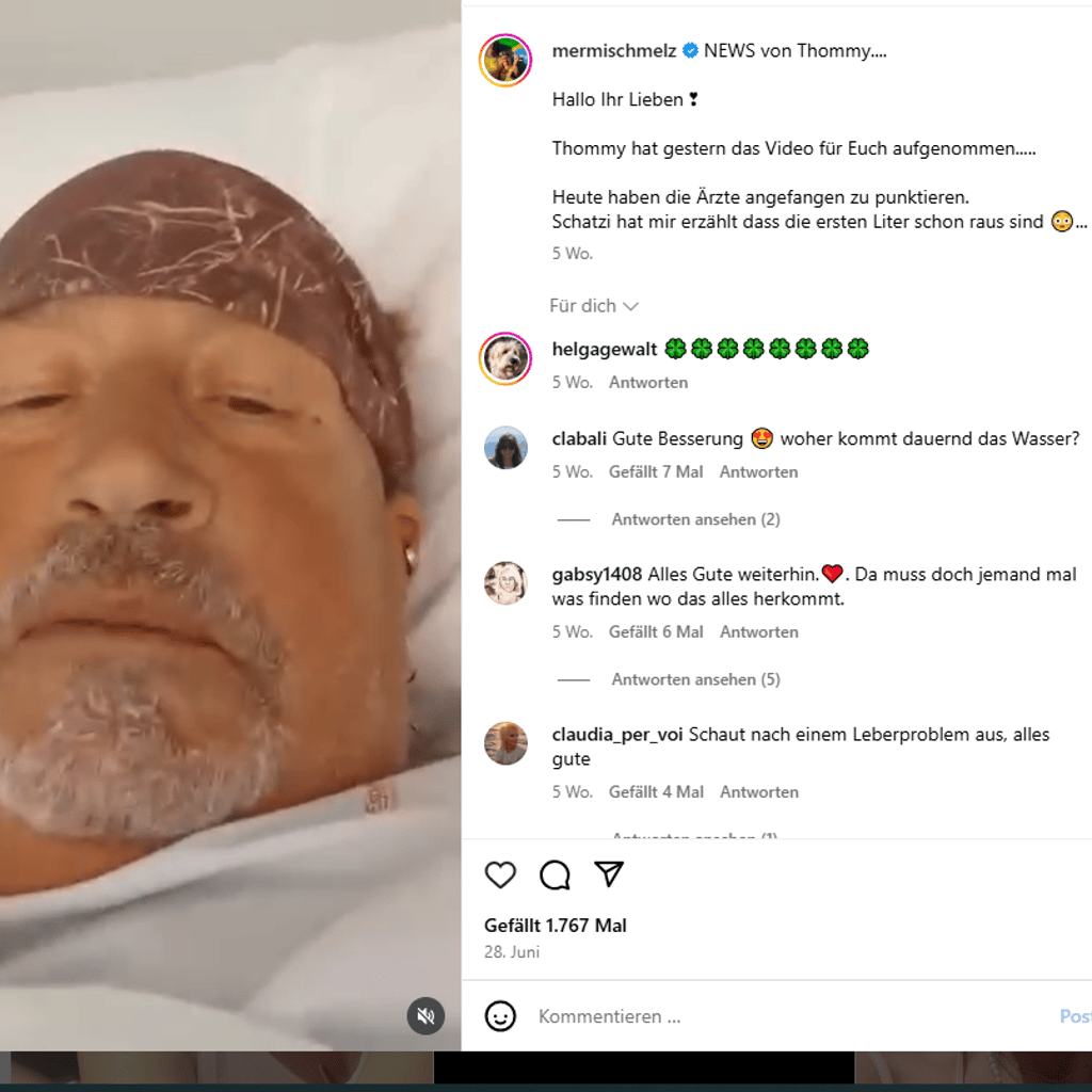 Der Mallorca-Auswanderer Thommy Schmelz liegt immer noch im Krankenhaus. Ihm geht es aber etwas besser.