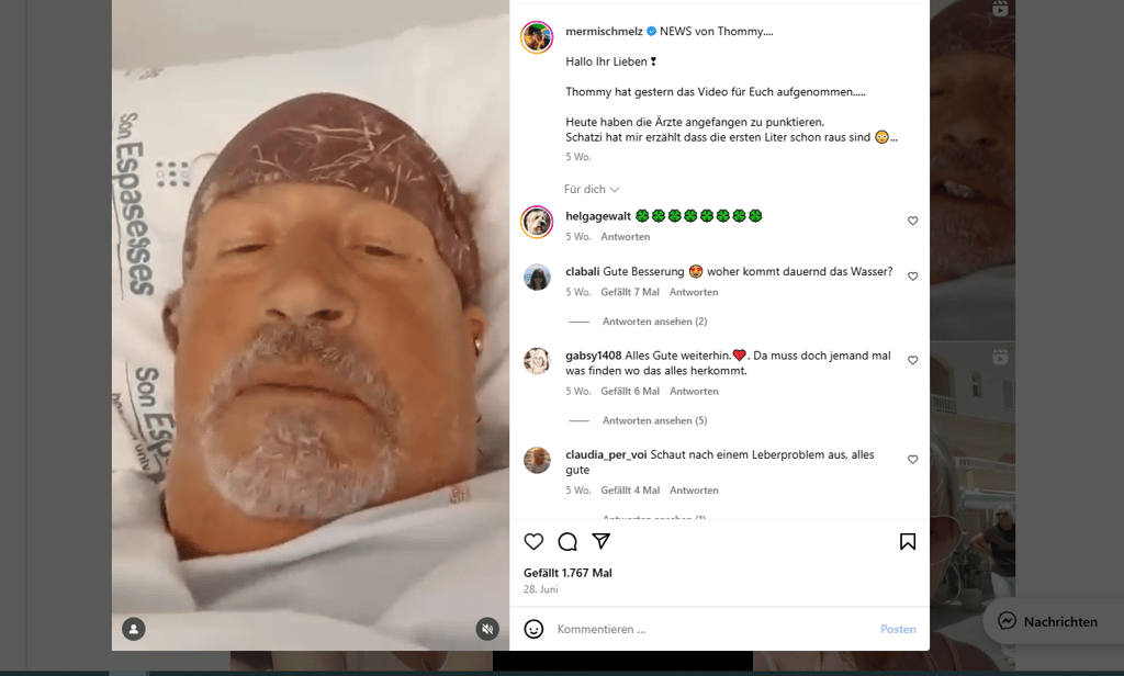 Der Mallorca-Auswanderer Thommy Schmelz liegt immer noch im Krankenhaus. Ihm geht es aber etwas besser.