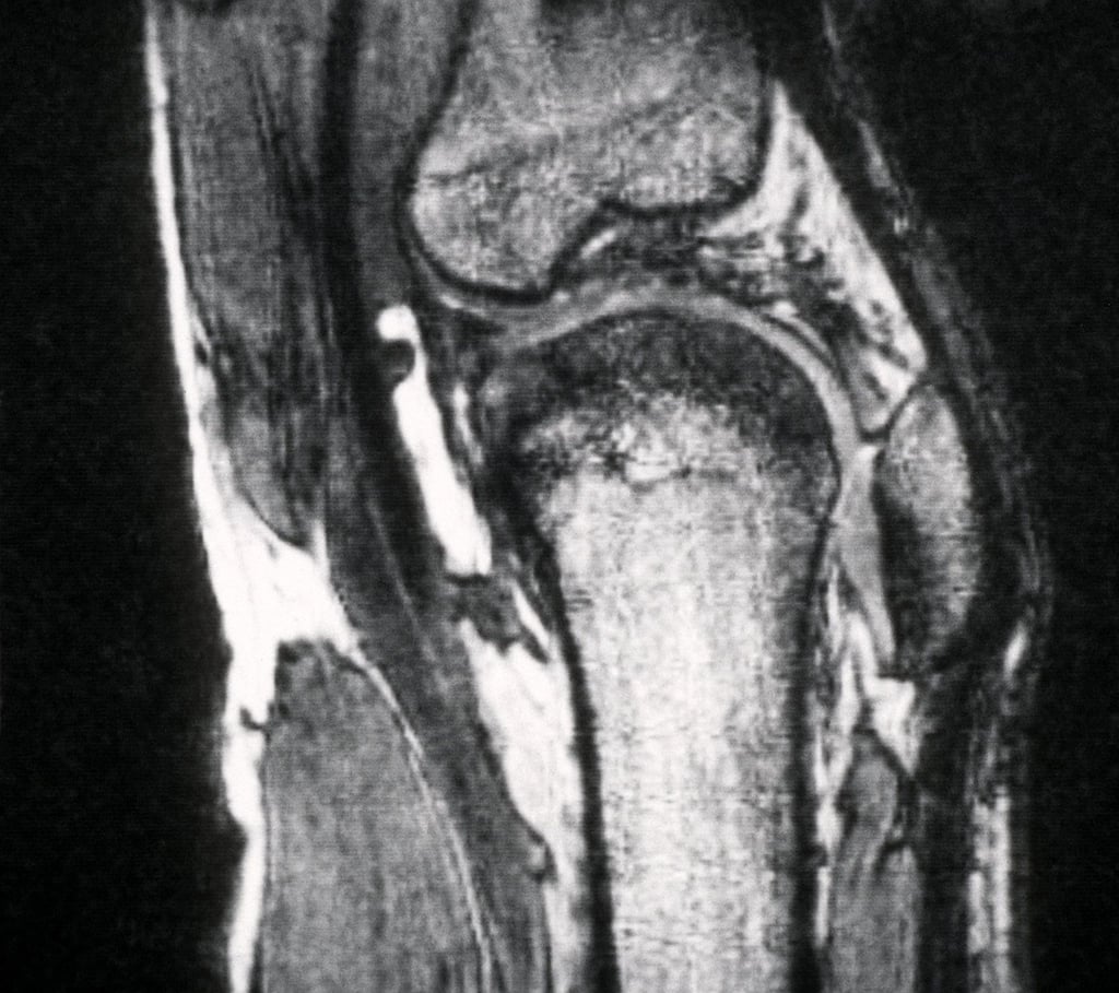 Schmerzen im Knie treiben viele Versicherte zum Orthopäden - viele kommen dort mit fragwürdigen Therapien in Kontakt. (Archivbild)
