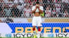 Luca Jaquez hat sich im Spiel gegen Union Berlin eine Verletzung im Gesicht zugezogen.