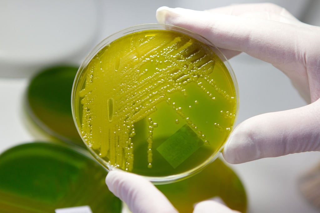 In Zwiebelmettwurst der Schleizer Fleisch- und Wurstwaren GmbH wurden Escherichia-coli-Bakterien (Ehec) nachgewiesen. (Archivbild)