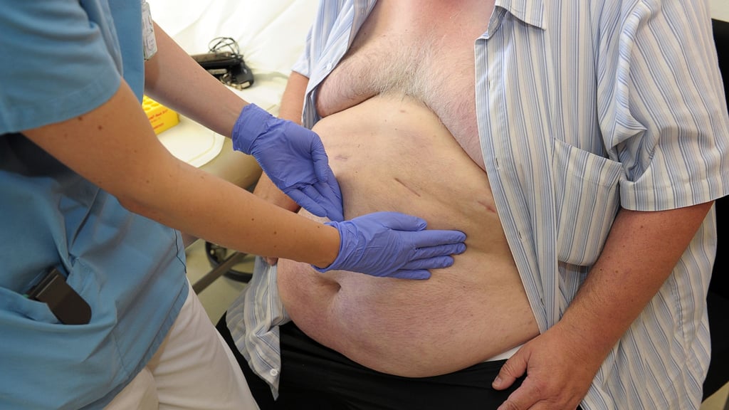 In Sachen Herzgesundheit gehört die Region zu den Schlusslichtern in Sachsen-Anhalt. Einer der Gründe ist Übergewicht.