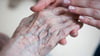 Schätzungen zufolge leiden rund 1,2 Millionen Menschen in Deutschen an Alzheimer (Symbolbild).