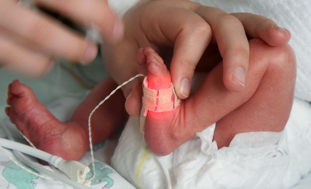 Ein Frühchen im Krankenhaus mit einem Sensor am Fuß: Ab 2025 müssen Kliniken für besonders kleine Neugeborene mindestens 25 Fälle im Jahr nachweisen.