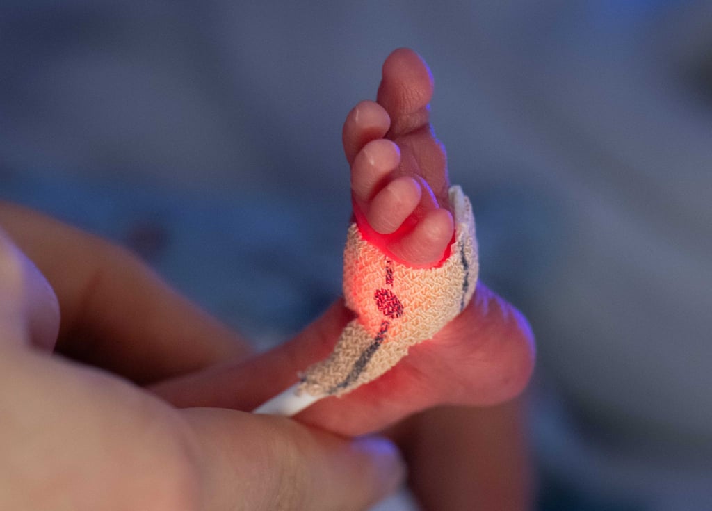 In Magdeburg wurde ein Baby mit nur 300 Gramm geboren und erfolgreich gepflegt. (Symbolbild)