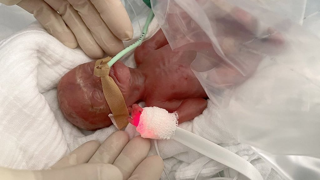 In Magdeburg kämpfte sich ein Frühchen ins Leben. Heute ist das Kind gesund.