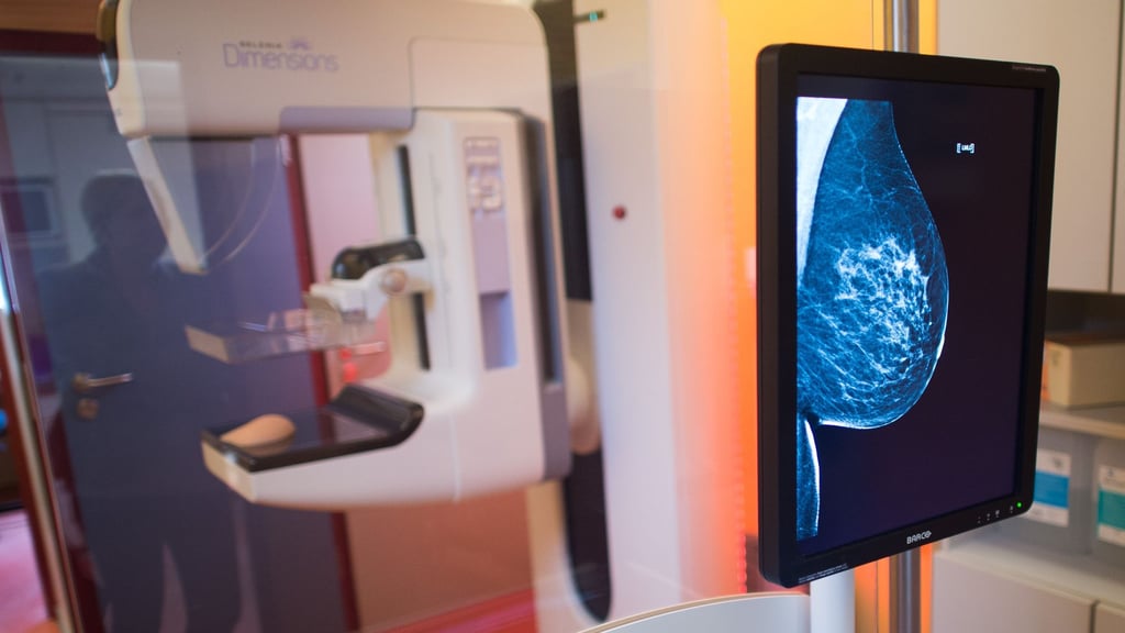 Zum Mammografie-Screening werden alle Frauen im Alter zwischen 50 und 69 Jahren jedes zweite Jahr eingeladen.