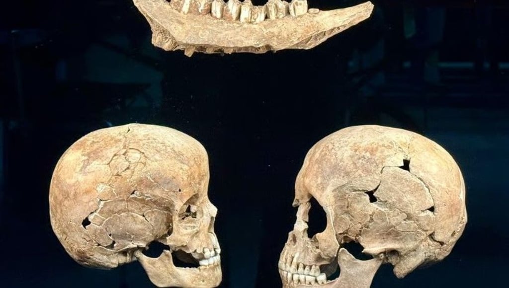 Tierknochen sowie Schädel eines Kindes mit einem Lochbruch durch stumpfe Gewalt und einer Frau zwischen 30 und 40 Jahren mit Trümmerfrakturen und Bissspuren eines Raubtieres wurden bei Grabungen aus einem der Opferschächte bei Pömmelte geborgen. Die Funde stammen aus der Zeit um 2350 bis 2050 v. Chr. und gehören zur neuen Dauerausstellung „Bronzerausch“.