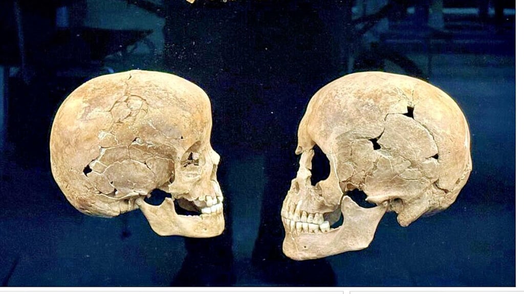 Tierknochen sowie Schädel eines Kindes mit einem Lochbruch durch stumpfe Gewalt und einer Frau zwischen 30 und 40 Jahren mit Trümmerfrakturen und Bissspuren eines Raubtieres wurden  bei Grabungen aus einem der Opferschächte bei Pömmelte geborgen. 