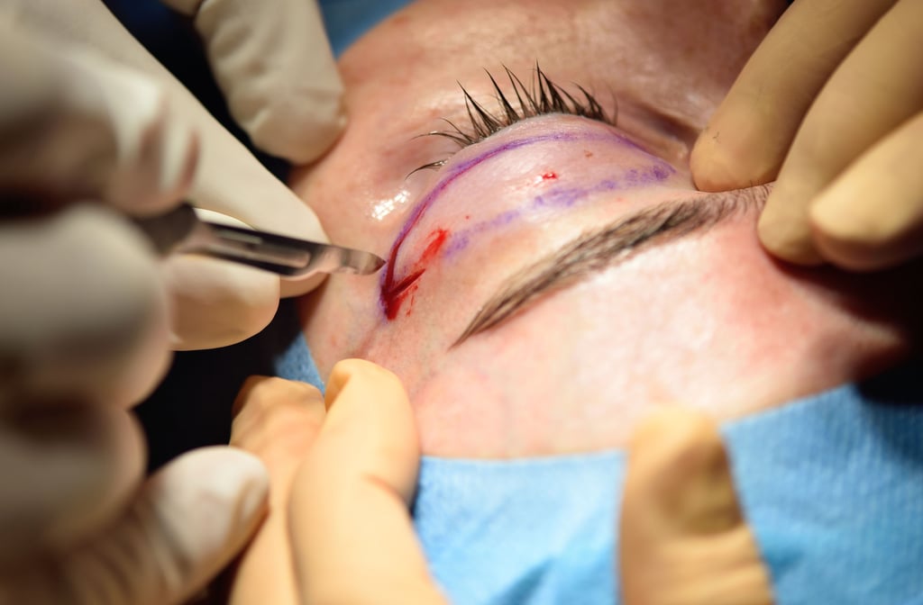 Immer mehr Menschen legen sich unters Messer. Diese Schönheitsoperationen liegen in Sachsen-Anhalt im Trend.