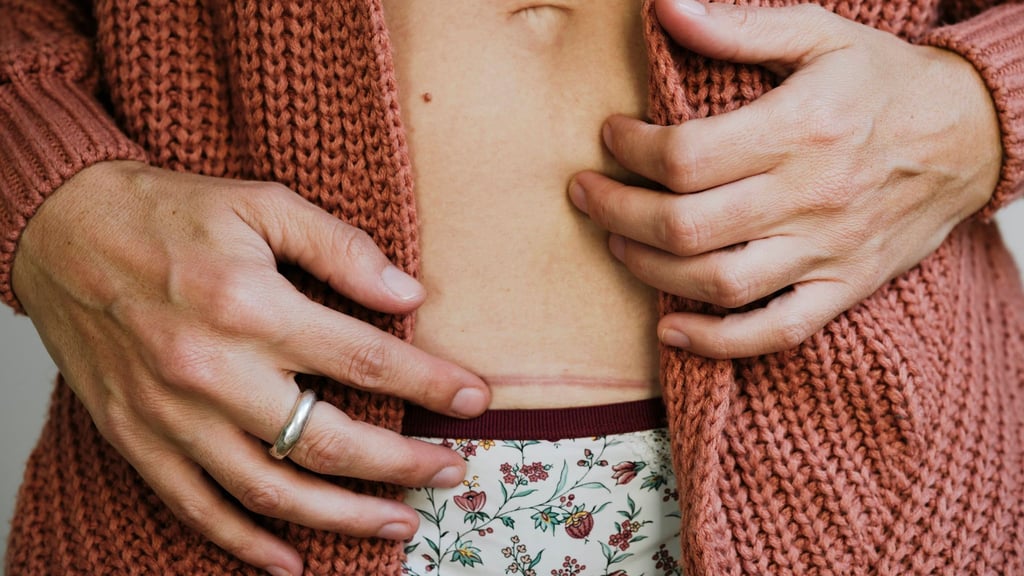 Sanfte Massagen und wenig Spannung: Das tut frischen Narben gut.