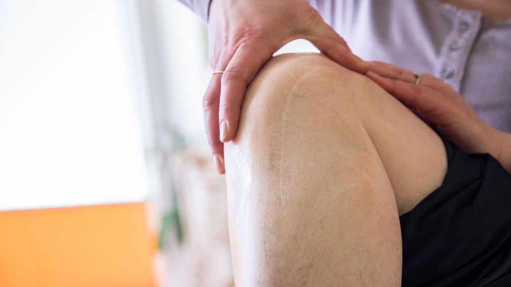 Es geht nicht nur ums Aussehen: Narben, die unschön verheilen, sind manchmal auch ein medizinisches Problem.