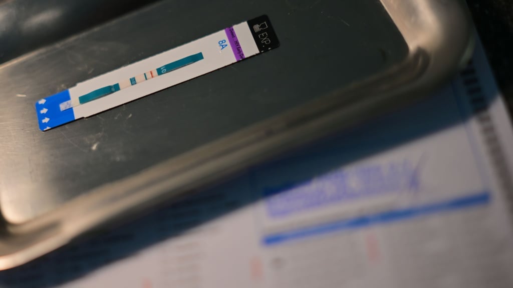 HIV-Diagnosen werden oft erst Jahre nach der Infektion gestellt. (Symbolbild)