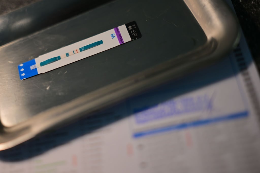 HIV-Diagnosen werden oft erst Jahre nach der Infektion gestellt. (Symbolbild)