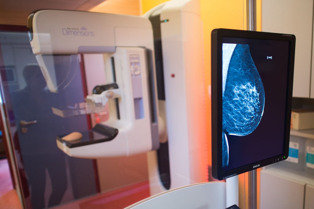 Alle zwei Jahre erhalten Frauen zwischen 50 und 75 eine Einladung zum Mammografie-Screening. (Symbolbild)