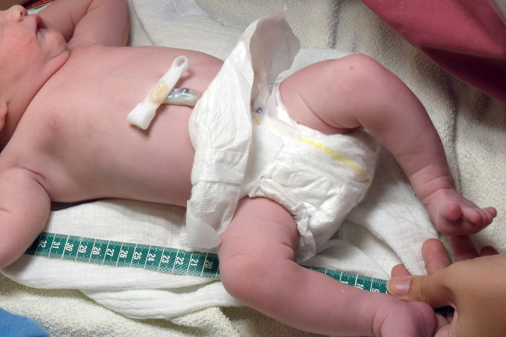 In Thüringen kündigen erste Hebammen wegen neuer Vergütungsregeln. (Symbolbild)