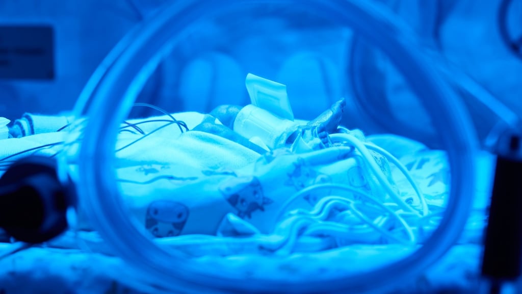 Extrem kleine Frühgeborene mit einem Geburtsgewicht von unter 1.250 Gramm werden ab dem kommenden Jahr nicht mehr in Suhl versorgt. (Symbolbild)