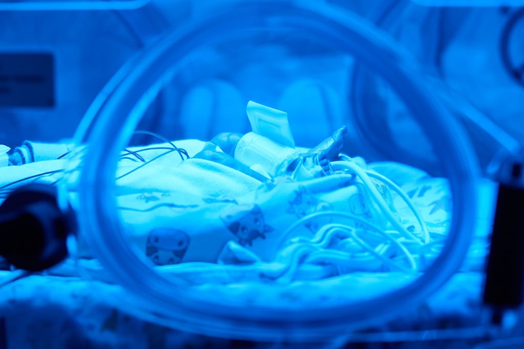 Extrem kleine Frühgeborene mit einem Geburtsgewicht von unter 1.250 Gramm werden ab dem kommenden Jahr nicht mehr in Suhl versorgt. (Symbolbild)