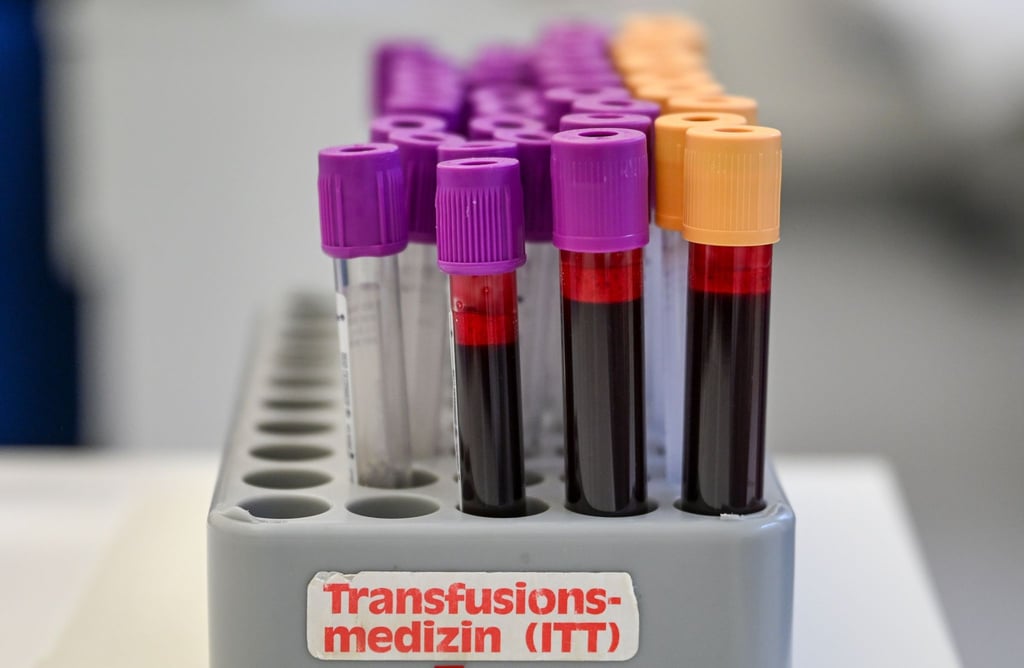 Eine Blutspende kann bis zu drei Menschen helfe (Symbolbild).