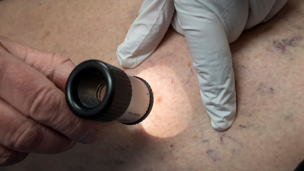 In Sachsen-Anhalt gibt es eine Anlaufstelle für Menschen mit seltenen Krankheiten. (Symbolbild)