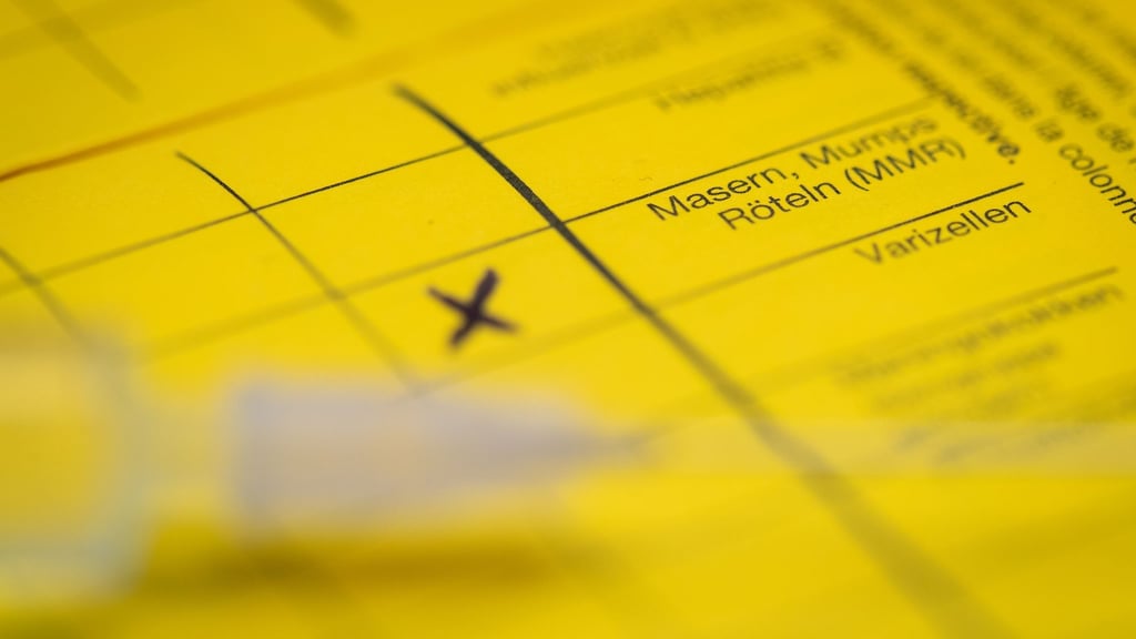 Bei Masern zeigt sich erst oft Fieber, bevor später ein Hautausschlag dazukommt. (Symbolbild)