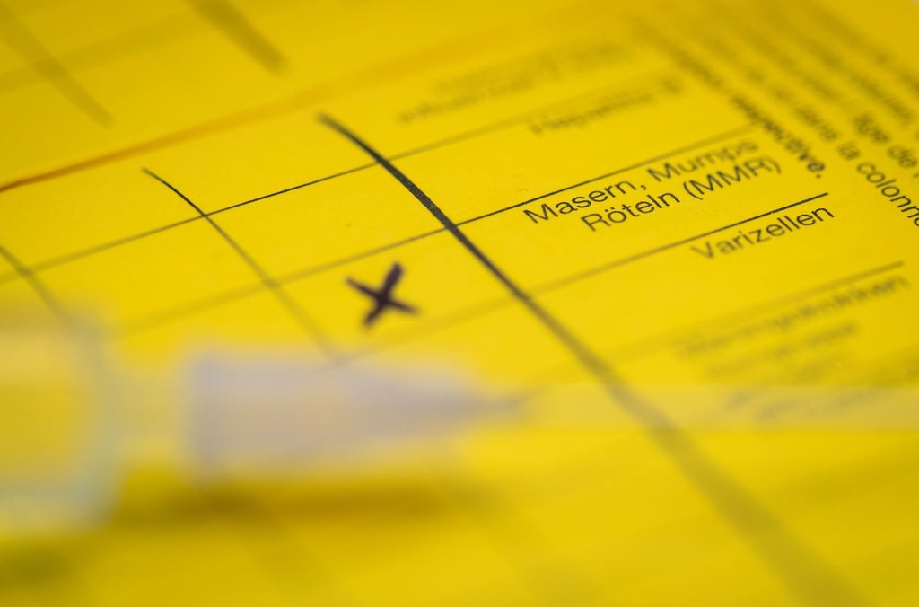 Bei Masern zeigt sich erst oft Fieber, bevor später ein Hautausschlag dazukommt. (Symbolbild)