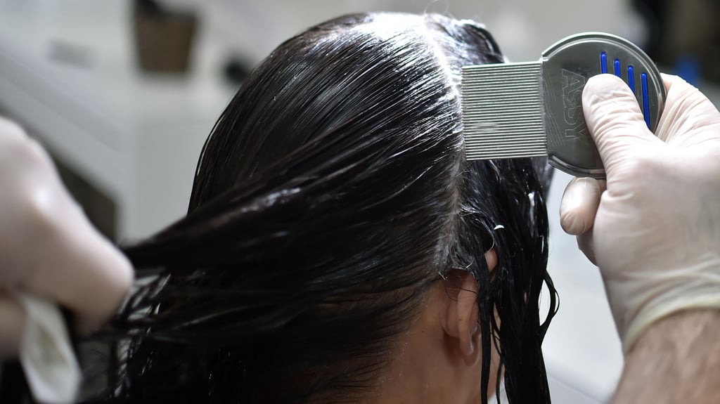 In Sachsen-Anhalt gibt es mehr Fälle von Läusebefall in den Kitas und Schulen. 