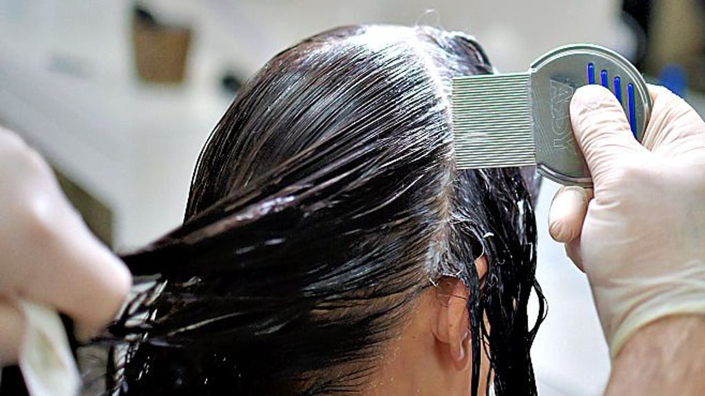 Um Läuse besser aus den Haaren entfernen zu können, gibt es spezielle Kämme.