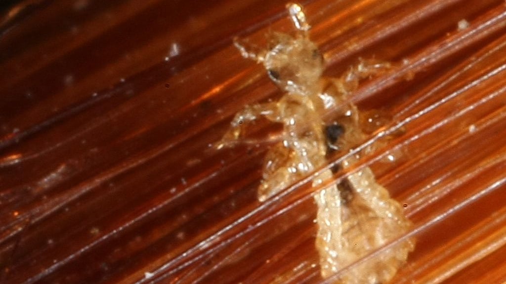 Unheimlich unbeliebt und selten wirklich gesehen wird dieser Mitbewohner.