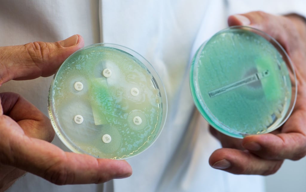 Krankenhauskeime ziehen sich Patienten während ihres Aufenthalts in einer medizinischen Einrichtung oder bei einer ambulanten Behandlung zu. (Archivbild)