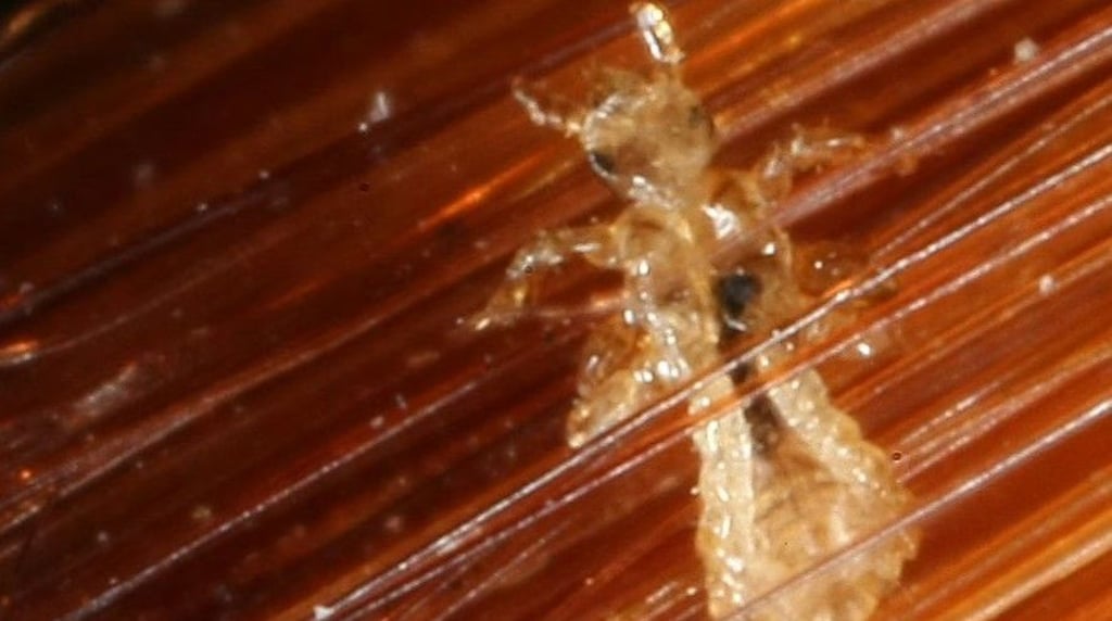 Unheimlich unbeliebt und selten wirklich gesehen wird dieser Mitbewohner.