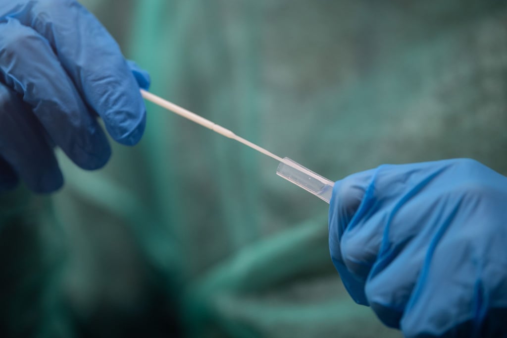 In Hannover steht ein 27-Jähriger vor Gericht, der eine überhöhte Anzahl Corona-Tests abgerechnet und einen Schaden von rund 1,64 Millionen Euro angerichtet haben soll. (Symbolbild)