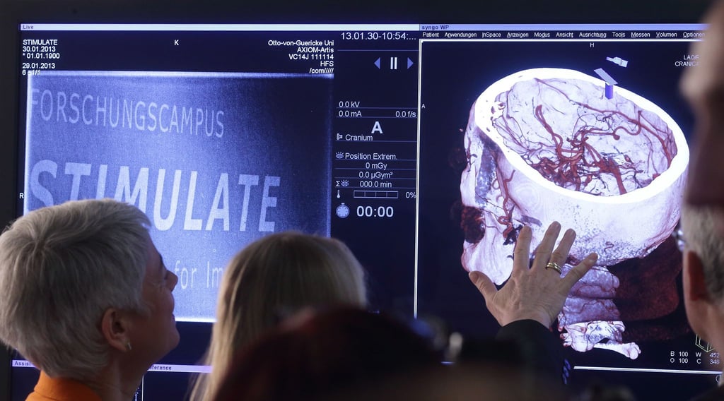 Auch Forschungsprojekte am Medizintechnik-Campus der Universität Magdeburg wurden wieder mit knapp zehn Millionen Euro gefördert. (Archivbild)