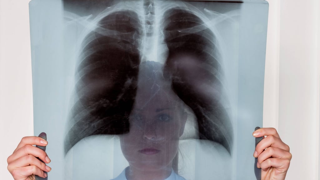 Ärztin mit einer Röntgenaufnahme: 57 Prozent der Sachsen-Anhalter warten laut einer Forsa-Umfrage länger als vier Wochen auf einen Facharzttermin.