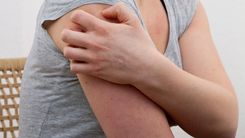 Kälte, Hitze, hormonelle Veränderungen, Infekte: Dem Auslöser einer Nesselsucht auf die Spur zu kommen, ist alles andere als einfach.