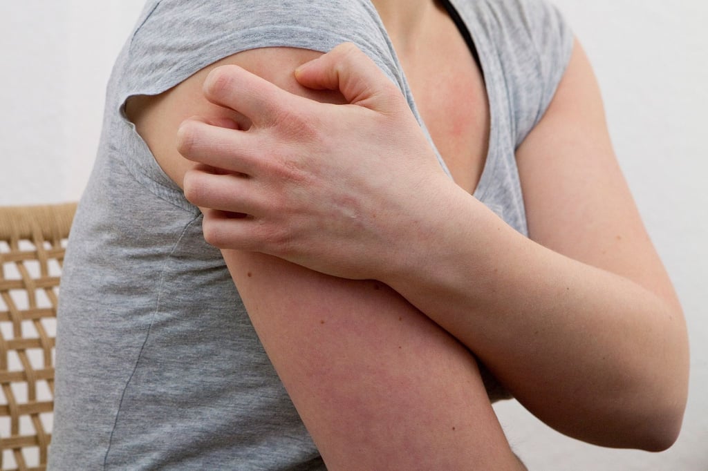 Kälte, Hitze, hormonelle Veränderungen, Infekte: Dem Auslöser einer Nesselsucht auf die Spur zu kommen, ist alles andere als einfach.