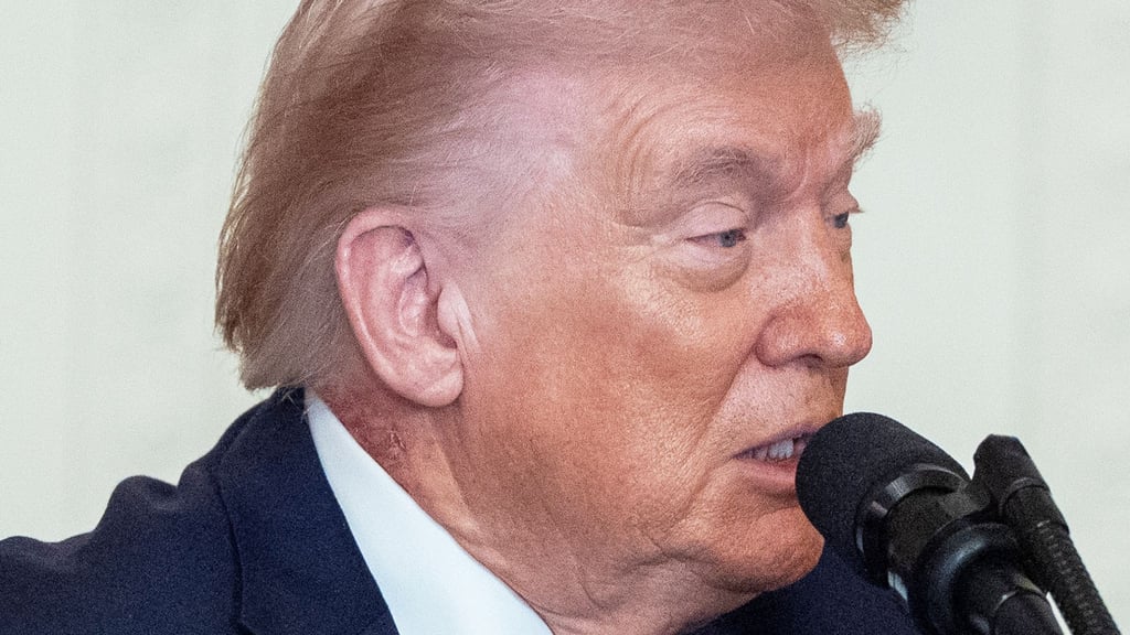 Eine Stelle an Trumps Hals hat eine Welle von Spekulationen über die Gesundheit des Präsidenten ausgelöst.